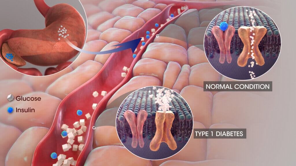 3D medical animation kwazulu natal